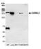 Capping Protein Regulator And Myosin 1 Linker 2 antibody, A305-831A-M, Bethyl Labs, Western Blot image 