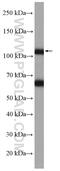 Angiomotin Like 2 antibody, 23351-1-AP, Proteintech Group, Western Blot image 