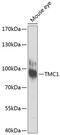 Transmembrane Channel Like 1 antibody, 23-681, ProSci, Western Blot image 