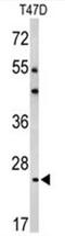 A1 antibody, AP50357PU-N, Origene, Western Blot image 