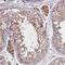 Zinc Finger MYM-Type Containing 4 antibody, HPA051301, Atlas Antibodies, Immunohistochemistry frozen image 