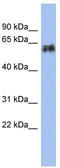Keratin 75 antibody, TA344209, Origene, Western Blot image 