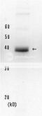 XPA, DNA Damage Recognition And Repair Factor antibody, 70-032, BioAcademia Inc, Western Blot image 