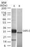 Seryl-TRNA Synthetase antibody, PA1-41158, Invitrogen Antibodies, Western Blot image 