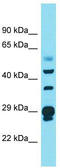 Crystallin Lambda 1 antibody, TA344266, Origene, Western Blot image 