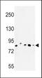 Chondroitin Polymerizing Factor antibody, 63-759, ProSci, Western Blot image 
