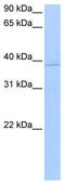 Annexin A8 Like 1 antibody, TA341648, Origene, Western Blot image 