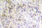 X-Ray Repair Cross Complementing 6 antibody, LS-C176657, Lifespan Biosciences, Immunohistochemistry frozen image 