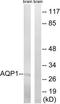 Aquaporin 1 (Colton Blood Group) antibody, TA312510, Origene, Western Blot image 