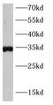 SRY-Box 2 antibody, FNab10148, FineTest, Western Blot image 