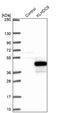 Kelch Domain Containing 9 antibody, NBP1-83068, Novus Biologicals, Western Blot image 