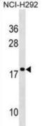 40S ribosomal protein S17-like antibody, abx025044, Abbexa, Western Blot image 