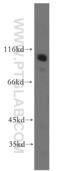 Membrane Metalloendopeptidase antibody, 10302-1-AP, Proteintech Group, Western Blot image 