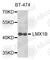LIM homeobox transcription factor 1-beta antibody, A6386, ABclonal Technology, Western Blot image 