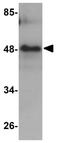 Rhomboid domain-containing protein 3 antibody, GTX85218, GeneTex, Western Blot image 