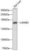 Laminin Subunit Beta 3 antibody, 15-132, ProSci, Western Blot image 
