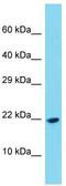 Platelet Derived Growth Factor C antibody, TA343169, Origene, Western Blot image 
