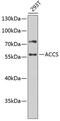 1-Aminocyclopropane-1-Carboxylate Synthase Homolog (Inactive) antibody, 14-992, ProSci, Western Blot image 