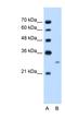 Follistatin antibody, NBP1-57996, Novus Biologicals, Western Blot image 