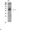 NK-3R antibody, LS-C813544, Lifespan Biosciences, Western Blot image 