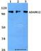 Disintegrin and metalloproteinase domain-containing protein 12 antibody, LS-C411891, Lifespan Biosciences, Western Blot image 