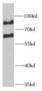 Metastasis Associated 1 Family Member 3 antibody, FNab05390, FineTest, Western Blot image 