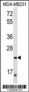 Peroxisomal Biogenesis Factor 11 Alpha antibody, 56-891, ProSci, Western Blot image 