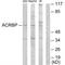 Acrosin Binding Protein antibody, A12806, Boster Biological Technology, Western Blot image 