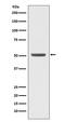 E2F Transcription Factor 2 antibody, M02896, Boster Biological Technology, Western Blot image 