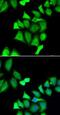UDP-Galactose-4-Epimerase antibody, FNab03309, FineTest, Immunofluorescence image 