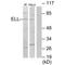 Elongation Factor For RNA Polymerase II antibody, A03336, Boster Biological Technology, Western Blot image 