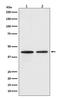 C-C Motif Chemokine Receptor 9 antibody, M02348, Boster Biological Technology, Western Blot image 