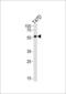 Cytochrome P450 Family 27 Subfamily B Member 1 antibody, MBS9201332, MyBioSource, Western Blot image 
