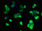 V-type proton ATPase 116 kDa subunit a isoform 2 antibody, orb39289, Biorbyt, Immunofluorescence image 