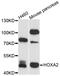 Homeobox protein Hox-A2 antibody, A05671, Boster Biological Technology, Western Blot image 