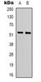 Lipase I antibody, abx133719, Abbexa, Western Blot image 