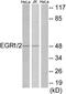 Krox-24 antibody, TA313795, Origene, Western Blot image 