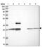 Matrix Remodeling Associated 7 antibody, NBP1-93731, Novus Biologicals, Western Blot image 