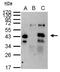 XPA, DNA Damage Recognition And Repair Factor antibody, GTX103168, GeneTex, Immunoprecipitation image 