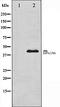 Mitogen-Activated Protein Kinase 8 Interacting Protein 3 antibody, orb106445, Biorbyt, Western Blot image 