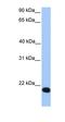Putative zinc finger protein 833 antibody, orb325575, Biorbyt, Western Blot image 