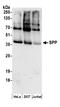 Histocompatibility Minor 13 antibody, A304-404A, Bethyl Labs, Western Blot image 
