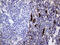 Melanophilin antibody, M06081, Boster Biological Technology, Immunohistochemistry paraffin image 