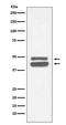 Keratin 18 antibody, M01357-2, Boster Biological Technology, Western Blot image 