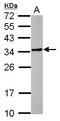 POM121 And ZP3 Fusion antibody, LS-C155709, Lifespan Biosciences, Western Blot image 