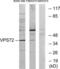 Vacuolar Protein Sorting 72 Homolog antibody, LS-B8421, Lifespan Biosciences, Western Blot image 