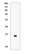 Probetacellulin antibody, A02171-3, Boster Biological Technology, Western Blot image 