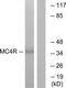 Melanocortin receptor 4 antibody, TA314181, Origene, Western Blot image 