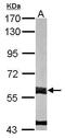 Dimethylaniline monooxygenase [N-oxide-forming] 3 antibody, GTX103521, GeneTex, Western Blot image 