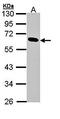 Pancreatic lipase antibody, orb69812, Biorbyt, Western Blot image 